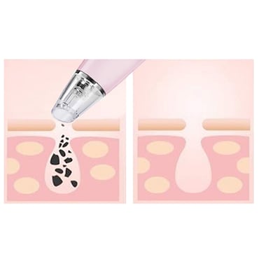 Magnitone PorePatrol Skin Renewing Pore Extraction System (Pink) image 4