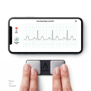 Review of Alivecor KardiaMobile ECG Heart Monitor