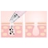 Magnitone PorePatrol Skin Renewing Pore Extraction System (Pink) image 4