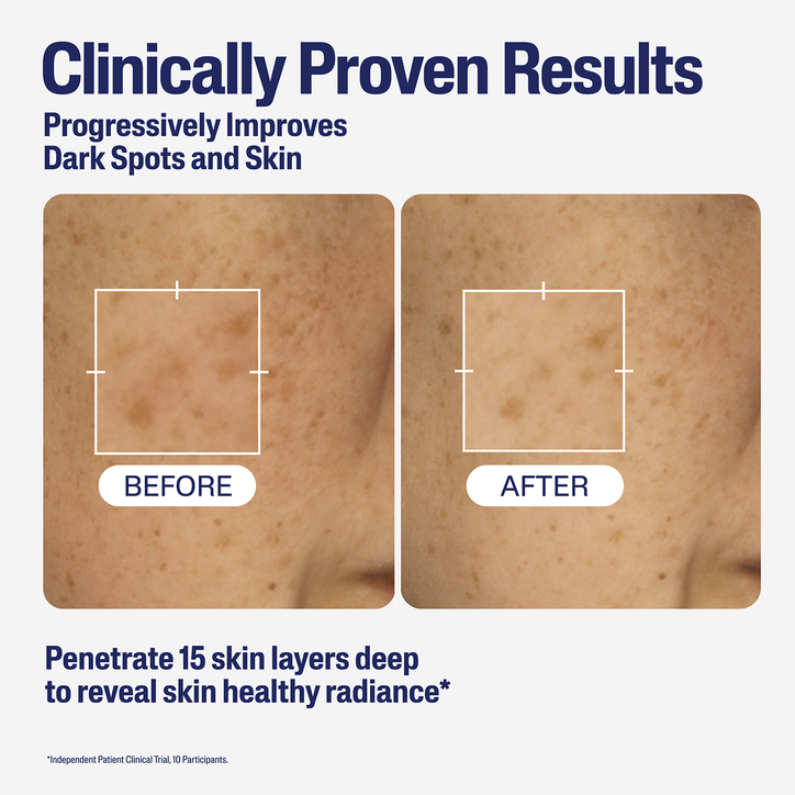 Cetaphil Healthy Radiance Brightening Niacinamide Serum 30ml image 5