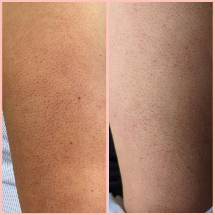 Frank Body Glycolic Body Scrub 250g image 7