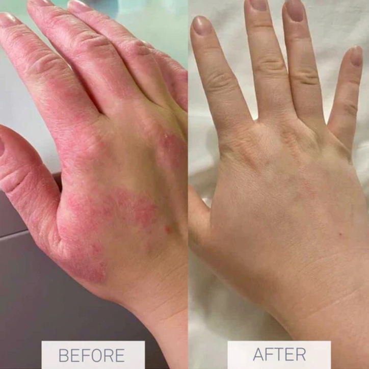 Nursem Caring Skin Fix 50ml image 6