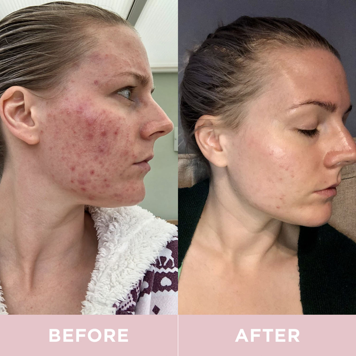 Revive Collagen Premium Liquid Marine Collagen Drink 8,500mgs 14 Sachets image 4