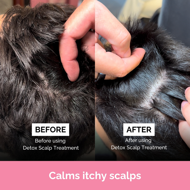 Ful Detox Scalp Treatment 150ml image 5