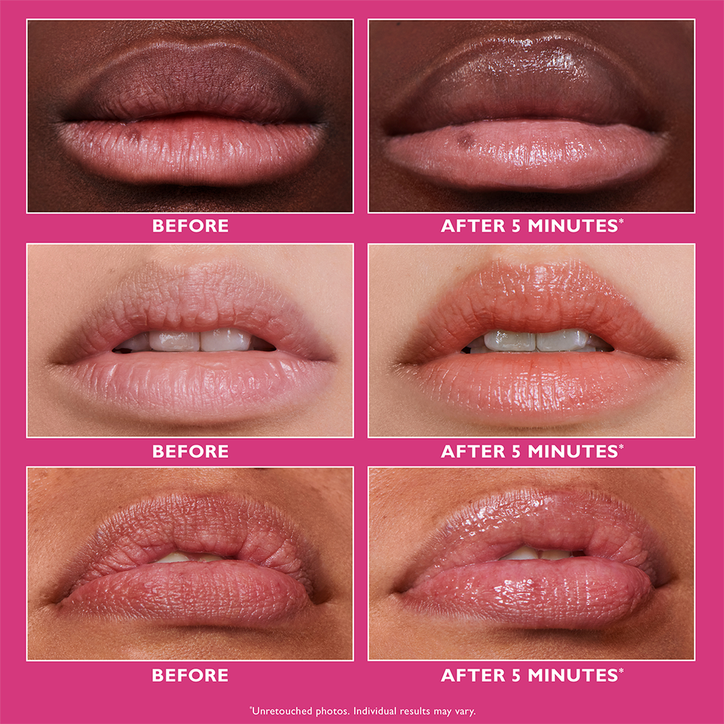 Peter Thomas Roth Instant Firmx Lip Filler 10ml image 5