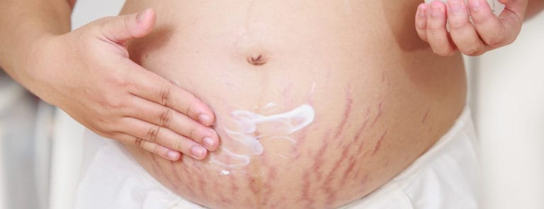 Young pregnant woman applying moisturizer on stretch marks