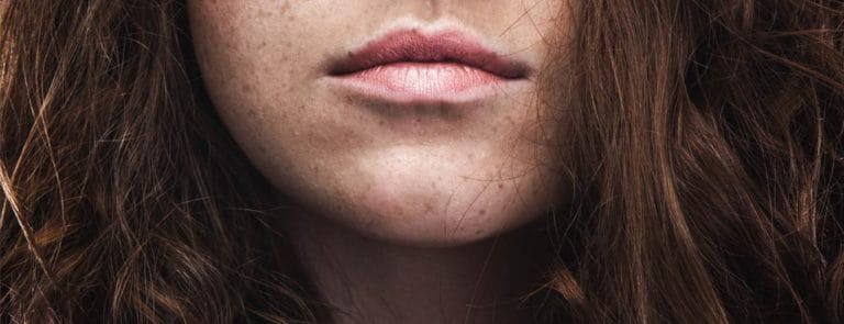 Woman with freckled face