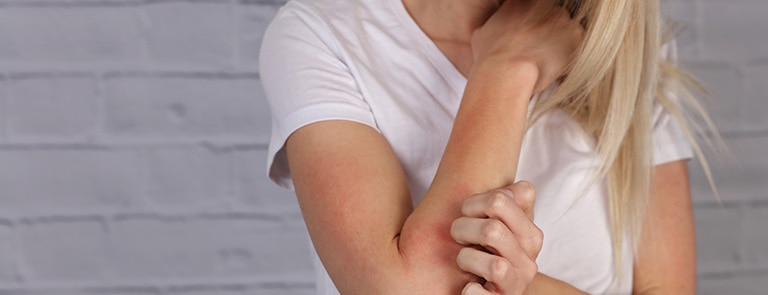 Eczema vs dermatitis. What’s causing your dry, itchy skin? Is it a type of dermatitis? Or should you really be calling it eczema?