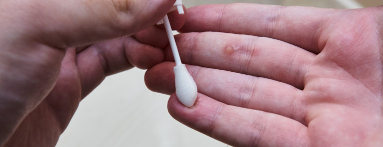at home wart removal by freezing