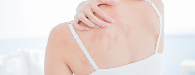 Is my skin rash from stress? image